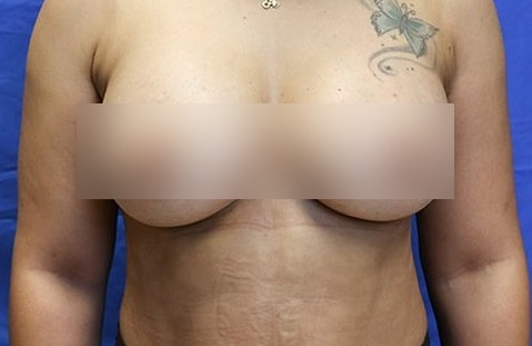 After image