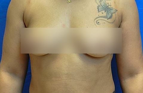 Before image