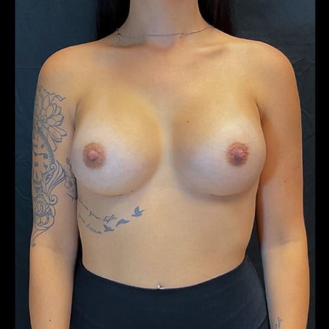 After image