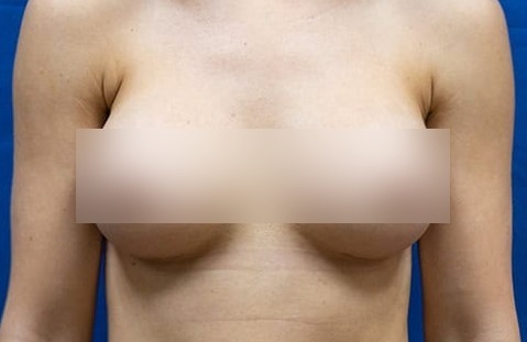 After image