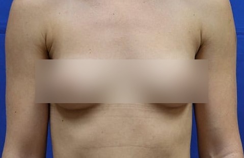Before image