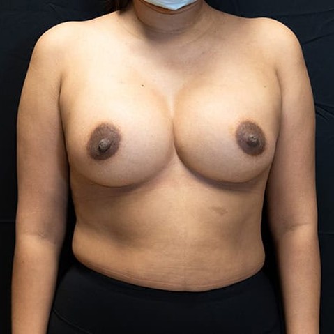 After image