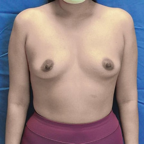 Before image