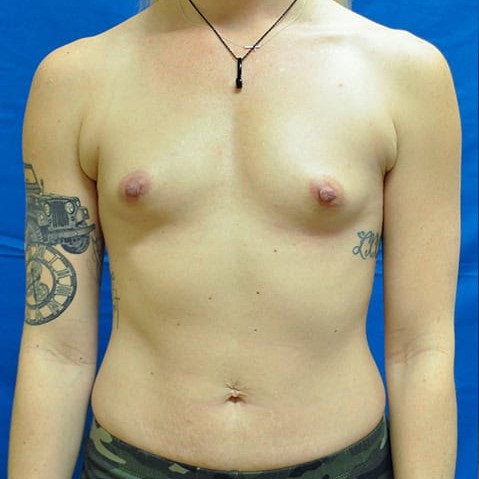 Before image