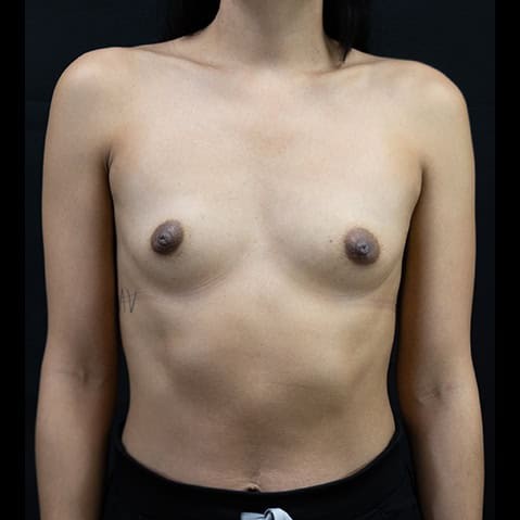 Before image