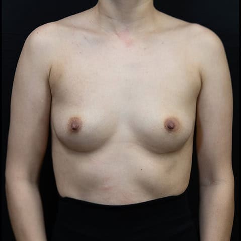 Before image