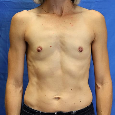 Before image