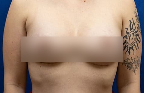 After image