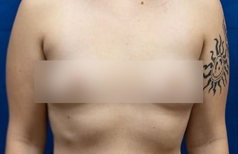 Before image