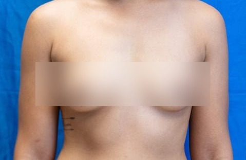 Before image